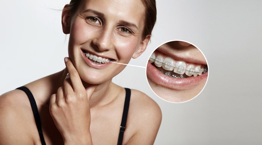 Ortodontist ve Diş Hekimi Arasındaki Farklar Nelerdir?